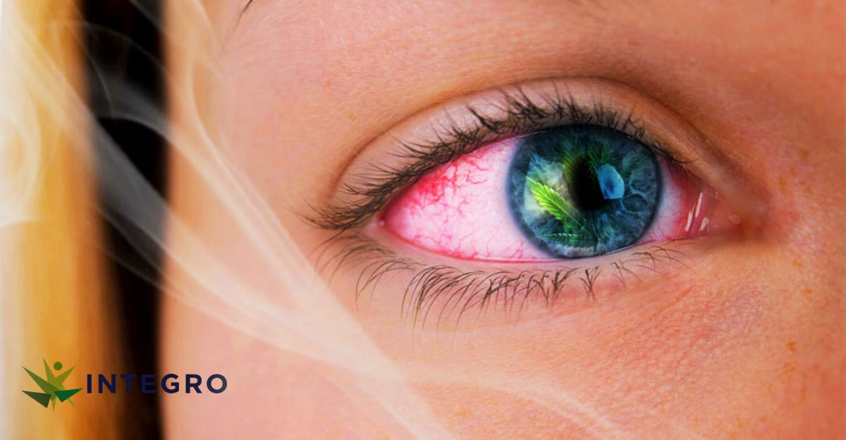 How Long Do Red Eyes Last From Weed?